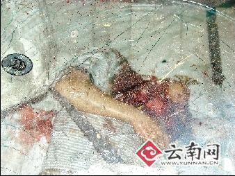 现场惨不忍睹