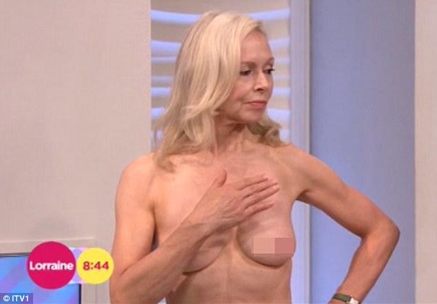 美电视节目邀请女志愿者示范自查乳腺获好评(图)